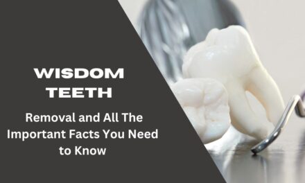 Wisdom Teeth- Removal and All Other Important Facts You Need to Know