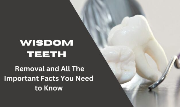 Wisdom Teeth- Removal and All Other Important Facts You Need to Know