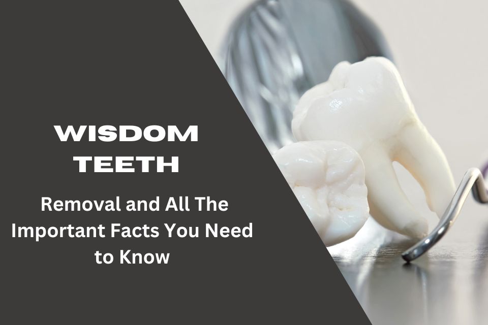 Wisdom Teeth- Removal and All Other Important Facts You Need to Know